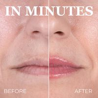 HOT KISS Lip Plumper Image - 2
