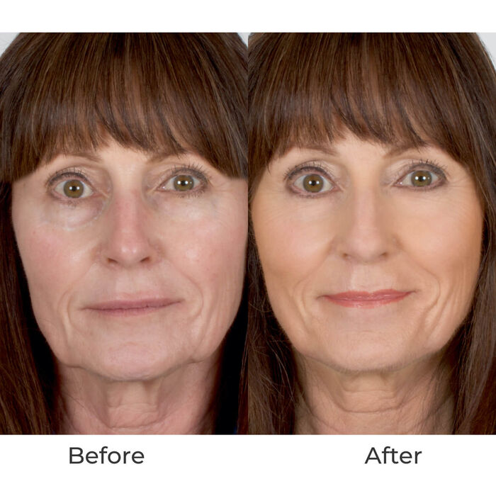 Breeze2 Single-Speed Silk 4-in-1 Airbrush Foundation Professional Bundle